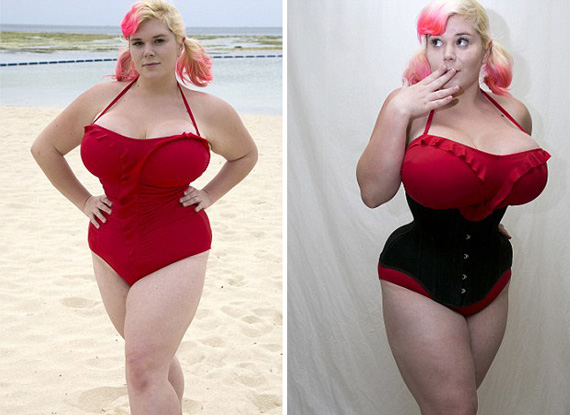 妇科手术被拍照 医院组织观摩其<em>私处</em>索赔10万